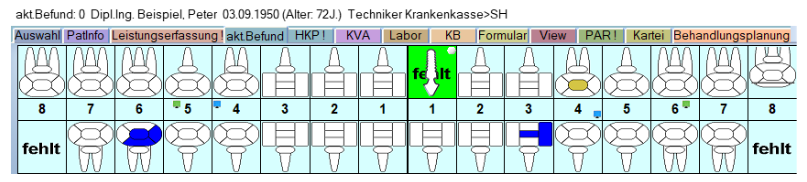 Z1.PRO HKP-Planung