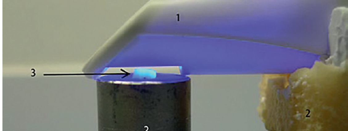 Demineralisierung