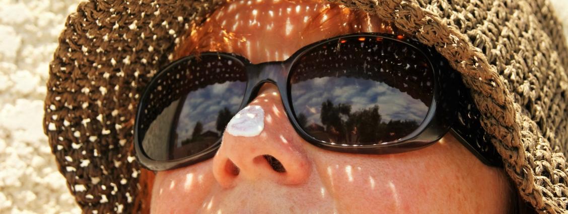 Sonnenschutz Frau mit Sonnenhut, Sonnenbrill und Creme auf der Nase