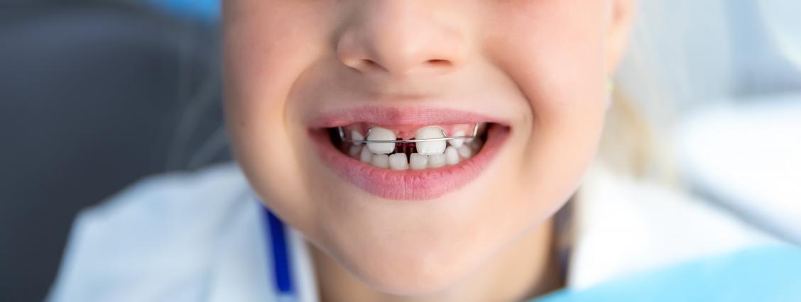 Mundgesundheit bei Kinder Mädchen schaut in die Kamera