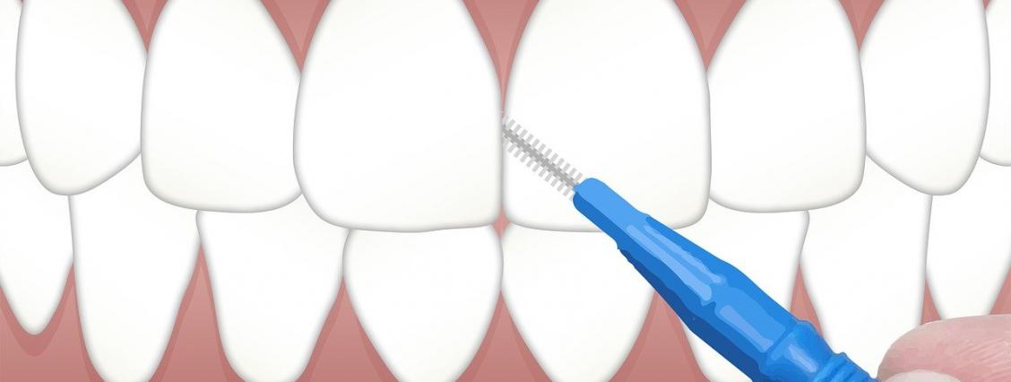 Zahnreinigung Interdental