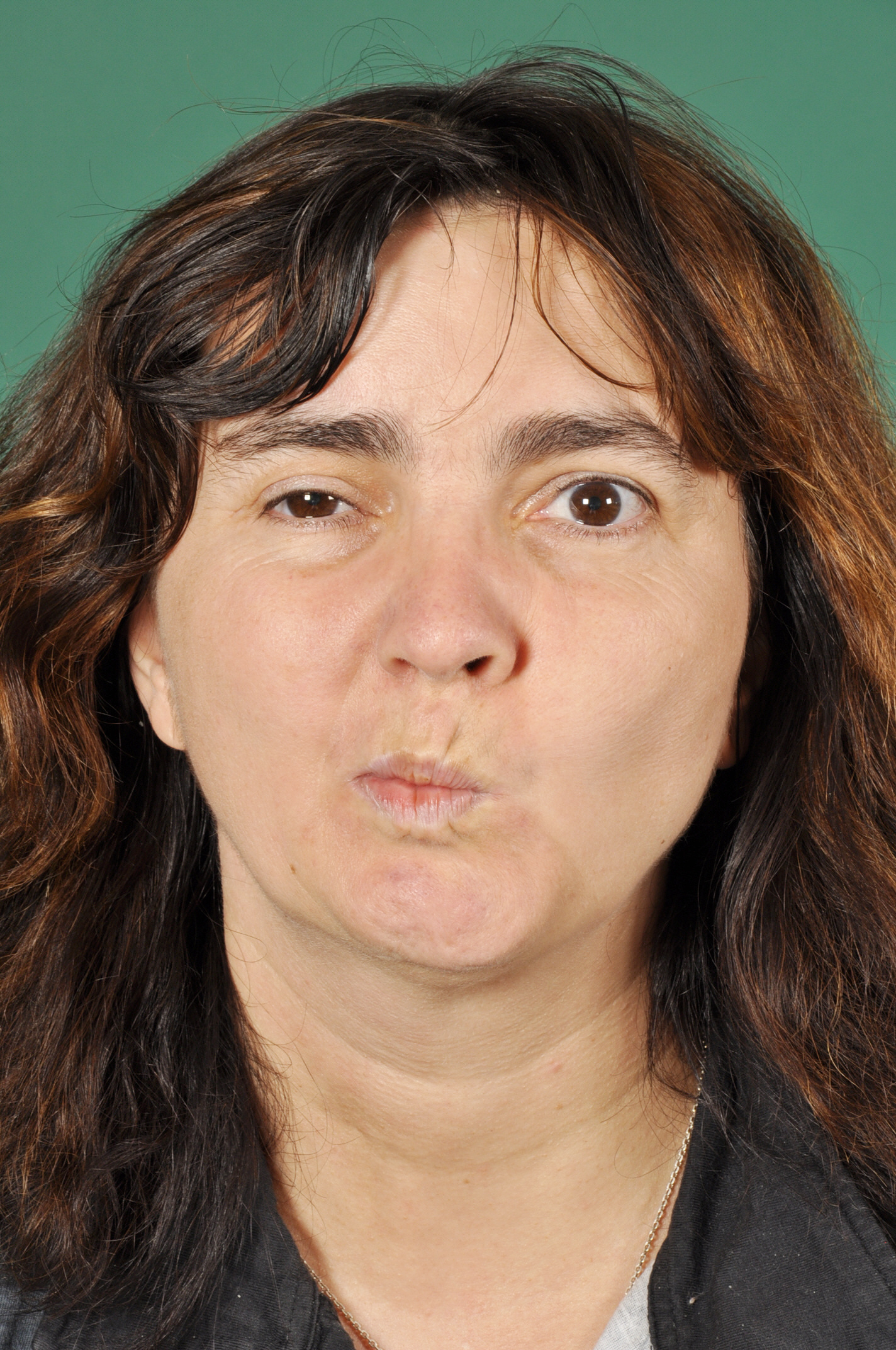 Abb. 1b: Mund spitzen – eingeschränkte Beweglichkeit