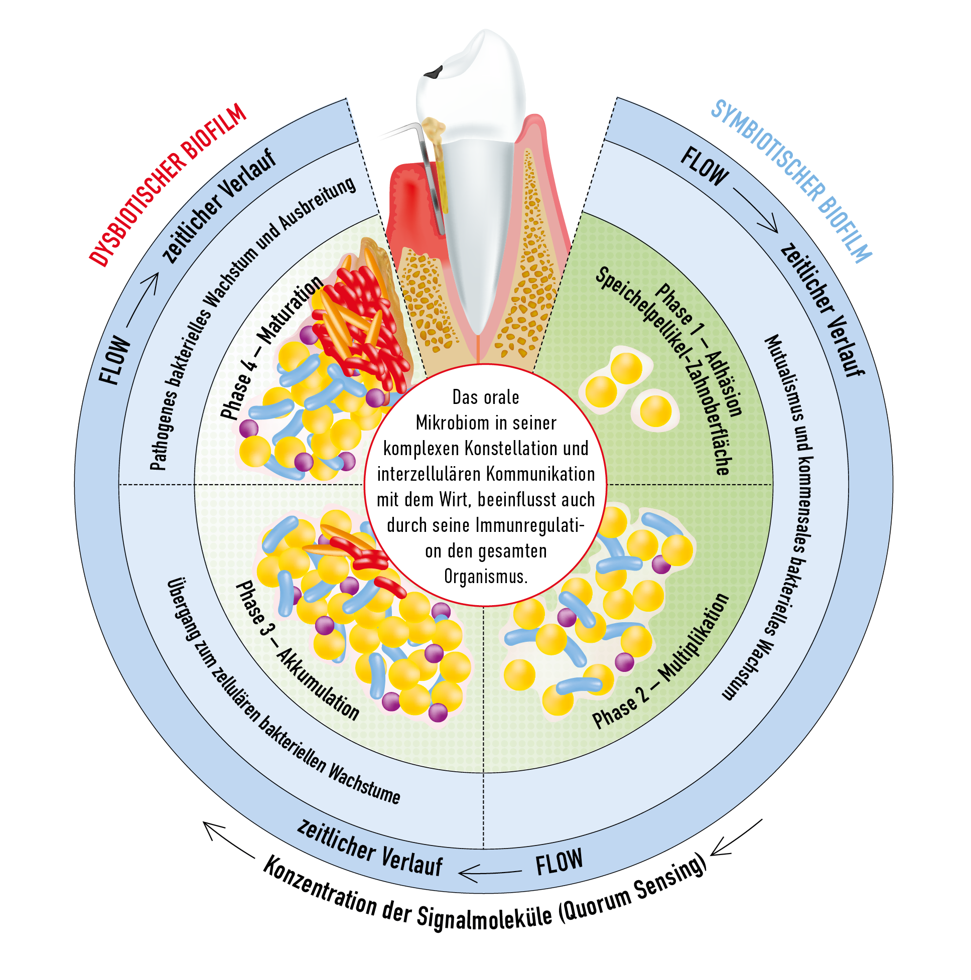Phasenverlauf einer pathologischen Biofilm-Entwicklung - Übergang von Eubiose zu Dysbiose