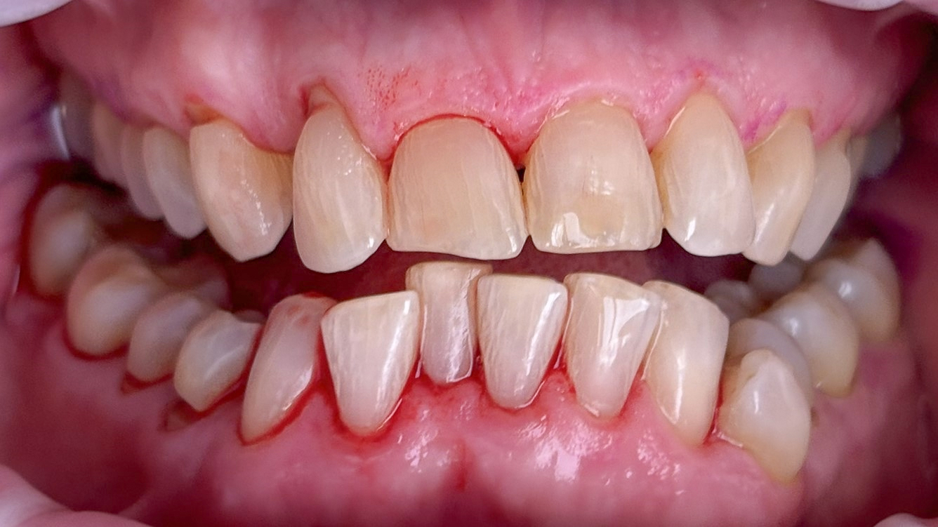 Abb. 7b: Klinischer Fall Nr. 1 (Fortsetzung).