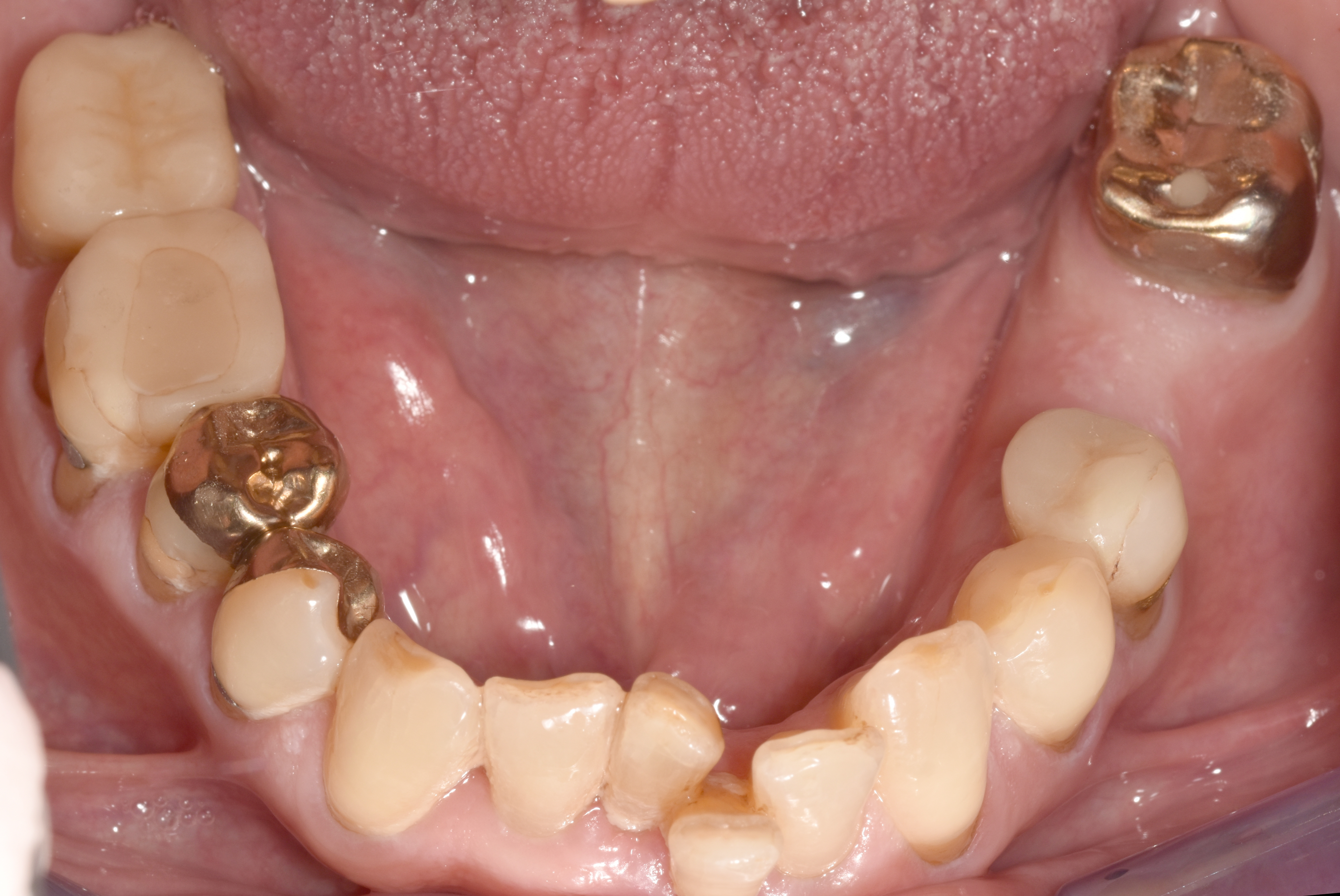 Abb. 1e: Aufsicht des Unterkiefers