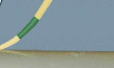 Symbolfoto einer Zahnarzthelferin bei der parodontalen Sondierung am Patienten.