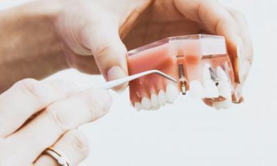 Gebissmodell mit Implantat, von Händen gehalten