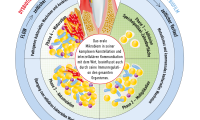 Phasenverlauf einer pathologischen Biofilm-Entwicklung - Übergang von Eubiose zu Dysbiose