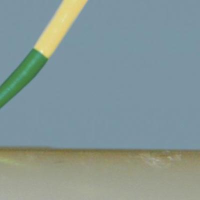 Symbolfoto einer Zahnarzthelferin bei der parodontalen Sondierung am Patienten.