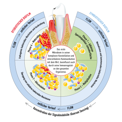 Phasenverlauf einer pathologischen Biofilm-Entwicklung - Übergang von Eubiose zu Dysbiose