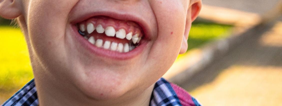 Kind lacht in die Kamera Kinderzahnheilkunde